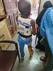 Below Knee Prosthesis – Singar Rehab