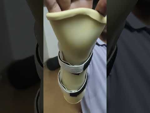 Finger Splint – Product Video – Singar Rehab